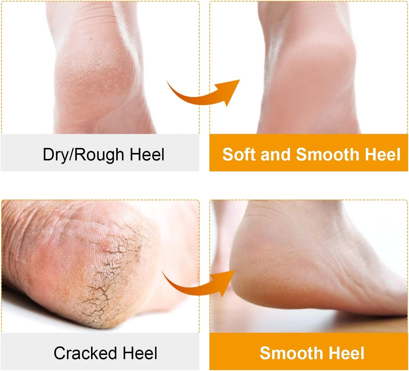 Pair Of Silicone Boat Heel Insole, Silicone Moisturizing Gel Sock, Anti Crack Protective Insole, Soft Open Toe Socks For Foot Care Protector, Shallow Boat Sock for Girls Ladies, Nonslip Gel Moisturizing Socks Foot Care Pair Of Silicone Boat Heel Insole, Silicone Moisturizing Gel Sock, Anti Crack Protective Insole, Soft Open Toe Socks For Foot Care Protector, Shallow Boat Sock for Girls Ladies, Nonslip Gel Moisturizing Socks Foot Care